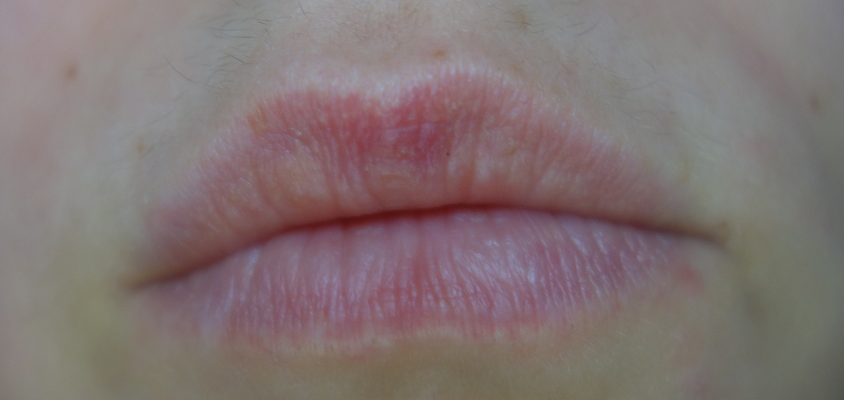 White Line Around The Lips Rebecca Wood