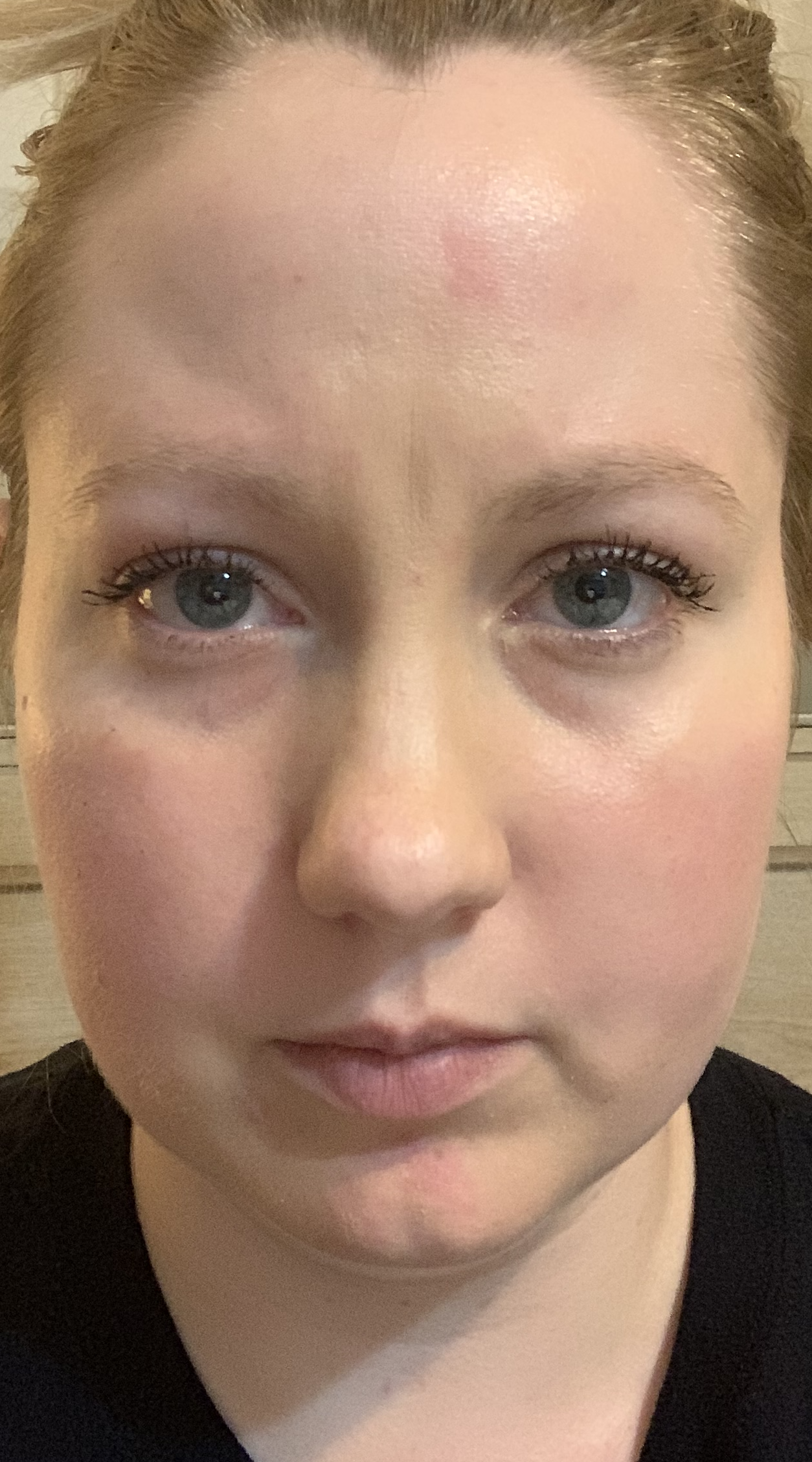 Kidney Stones, Water Retention and Face Reading - Rebecca Wood